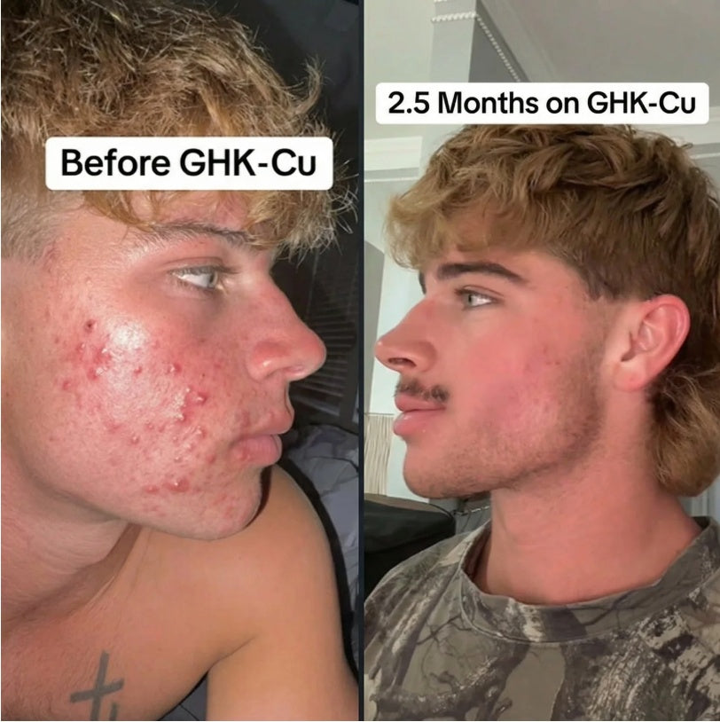 Before and after GHK-Cu