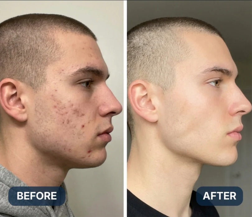Before and after